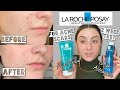 Видео - TESTING LA ROCHE POSAY EFFACLAR Lotion Astringent &amp; Micro-Peeling Gel  for ACNE SCARS