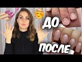 Видео - КАК БЫСТРО ОТРАСТИТЬ НОГТИ после гель лака💅 Ногти после наращивания💅Восстановление ногтей💅 Suzi Sky