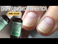 Видео - Онихолизис вернулся // Что делаем? Восстановление от INKI Profi