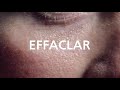 Видео - LAROCHE POSAY EFFACLAR  MAT _ صيدليات د / اسامة الطيبى