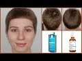 Видео - The Ordinary Hair Serum with La Roche Posay Kerium Extra Gentle Shampoo | 9 Weeks Results