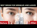 Видео - . &quot;Vichy Serum: The Secret to Long, Luscious Eyelashes and Youthful, Wrinkle-Free Skin&quot;