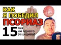 Видео - Как я победил ПСОРИАЗ: личный опыт. Мази, таблетки и нервы! Complete cure for psoriasis