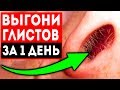 Видео - Соседка рассказала, как на утро вылез ком паразитов! Смешала обычные...