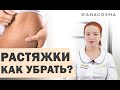 Видео - ❗️Как убрать растяжки и стрии?❗️❗️ 👍ТОП-процедур👍