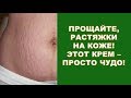 Видео - Прощайте, растяжки на коже! Этот крем - просто чудо!