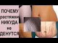 Видео - РАСТЯЖКИ: за что мне это и как их убрать??? #смирисьснеизбежным