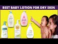 Видео - Best Baby Lotion For Dry Skin (How Do You Treat Dry Skin on A Baby?)