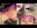 Видео - GRWM for Eczema Prone Skin – Skincare &amp; Makeup