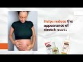 Видео - Palmer&#39;s Cocoa Butter Formula Stretch Marks Range