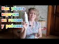 Видео - КАК УБРАТЬ МОЛОЧНЫЕ/СЕБОРЕЙНЫЕ/КОРОЧКИ НА ГОЛОВЕ У РЕБЕНКА/СУПЕР ШАМПУНЬ ОТ КОРОЧЕК