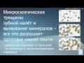 Видео - Apadent нано-космические пасты с гидроксиапатитом кальция.