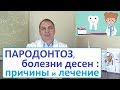 Видео - ПАРОДОНТОЗ, кровоточивость десен – как лечить. Причины болезней полости рта - неизвестные факты.