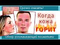 Видео - 128| SOS-УХОД для ПРОБЛЕМНОЙ КОЖИ | Покраснение лица - как помочь