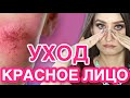 Видео - КУПЕРОЗ и РОЗАЦЕА 🟥 Уход при красноте кожи 😬