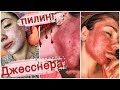 Видео - ГЛУБОКИЙ ПИЛИНГ ДЖЕССНЕРА/ 6 СЛОЕВ / ПЕРВЫЕ 3 ДНЯ