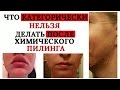 Видео - Типичные ошибки после химического пилинга! Что нельзя делать!