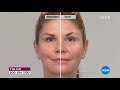 Видео - Rejuvatone MD by JeNu Microcurrent Facial Toning System