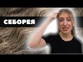 Видео - СЕБОРЕЯ кожи головы! Как выглядит? СИМПТОМЫ! Как лечить? Себорейный ДЕРМАТИТ!