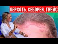 Видео - Себорейный дерматит на голове, лице и теле.