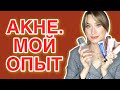 Видео - КАК Я ВЫЛЕЧИЛА АКНЕ ЗА МЕСЯЦ Уход и лечение