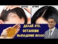 Видео - Предотвратите Выпадение Волос И Отрастите Волосы | Доктор Вивек