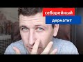 Видео - Себорейный дерматит, часть вторая. Что мне помогает, а что не дает эффекта (личный опыт)