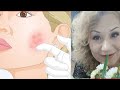 Видео - #drveronika sandul retinol IS IT NORMAL  Skin  ITCHY after RETINOL?What I use AHA Toner with RETINOL