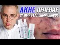 Видео - АКНЕ ЛЕЧЕНИЕ | самый реальный способ вылечить #акне НАВСЕГДА #роаккутан