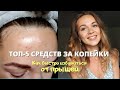 Видео - Топ-5 САМЫХ ДЕЙСТВЕННЫХ бюджетных средств от ПРЫЩЕЙ 🔥 КАК ИЗБАВИТЬСЯ ОТ ПРЫЩЕЙ БЫСТРО