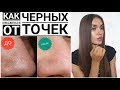 Видео - КАК Избавться От ЧЕРНЫХ ТОЧЕК | ДЕЙСТВЕННЫЕ СРЕДСТВА | Моя ИСТОРИЯ и СРЕДСТВА Ухода