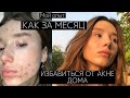 Видео - КАК ИЗБАВИТЬСЯ ОТ ПРЫЩЕЙ БЫСТРО?💕|ЛЕЧЕНИЕ АКНЕ|Чистая кожа 🤩Мой опыт Питание и Советы!