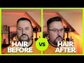 Видео - Before and After - Men&#39;s Review Matrix Miracle Creator