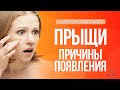 Видео - Причины появления прыщей