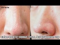 Видео - Салфетки для удаления черных точек Ciracle Blackhead Off Sheet