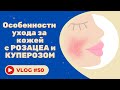 Видео - #50 Особенности ухода за кожей с розацеа и куперозом