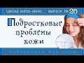 Видео - УХОД ЗА ПОДРОСТКОВОЙ КОЖЕЙ 👩 | Когда пора в аптеку, что и где купить, как питаться