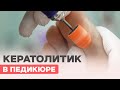 Видео - Педикюр с КЕРАТОЛИТИКОМ | Мягкая стопа за 2 минуты