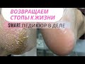 Видео - Возвращаем стопы к жизни!Выполняем Smart педикюр от и до! #педикюр #педикюрдисками