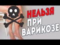 Видео - Что нельзя делать при варикозе?