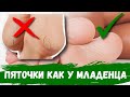 Видео - Трещины на пятках-как избавиться в домашних условиях. Крем для ног от трещин на пятках.