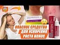 Видео - ОПАСНОЕ СРЕДСТВО ДЛЯ УСКОРЕНИЯ РОСТА ВОЛОС - НИКОТИНОВАЯ КИСЛОТА ОТЗЫВЫ