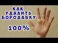 Видео - Как удалить бородавку - Я знаю способ 100%