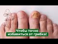 Видео - Чтобы точно избавиться от грибка ногтей! Антигрибковый спрей для обуви. Полезные советы.