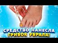 Видео - ПРОЩАЙ ГРИБОК! Это ЯДРЁНОЕ МАСЛО разъест весь грибок с ногтей и кожи!!