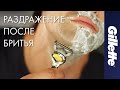 Видео - Как Избежать Раздражения После Бритья | Gillette ProShield