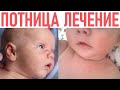 Видео - ПОТНИЦА У РЕБЕНКА | Как лечить, симптомы и профилактика