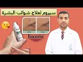 Видео - سيروم يوسرين الأفضل لعلاج بقع حب الشباب والمسام الواسعة Eucerin Dermopurifyer Triple Effect Serum