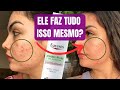 Видео - RESENHA EUCERIN DERMOPURE EFEITO TRIPLO PARA ACNE, OLEOSIDADE E MARCAS ESCURAS PÓS ACNE