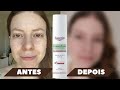 Видео - EUCERIN DermoPure Sérum Efeito Triplo, 8 meses de uso | Resultados em manchas pós acne | RESENHA